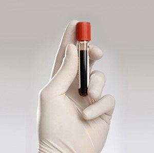 Arizona Court of Appeals Upholds Consent Blood Draw